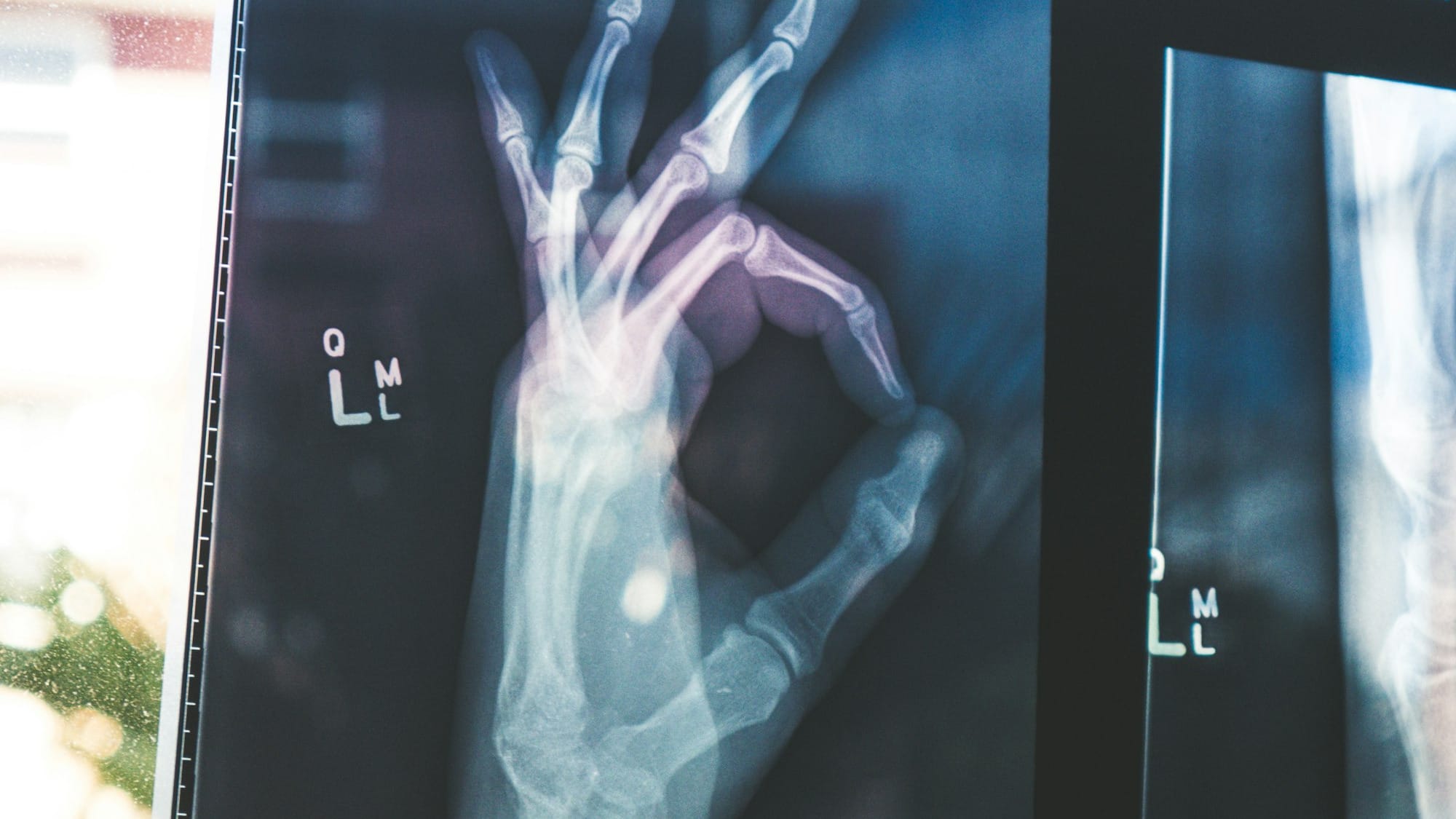 7 прорыров AI в медицине